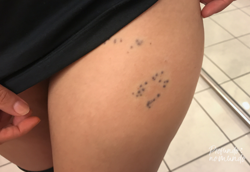 Marca dos espinhos de ouriço do mar